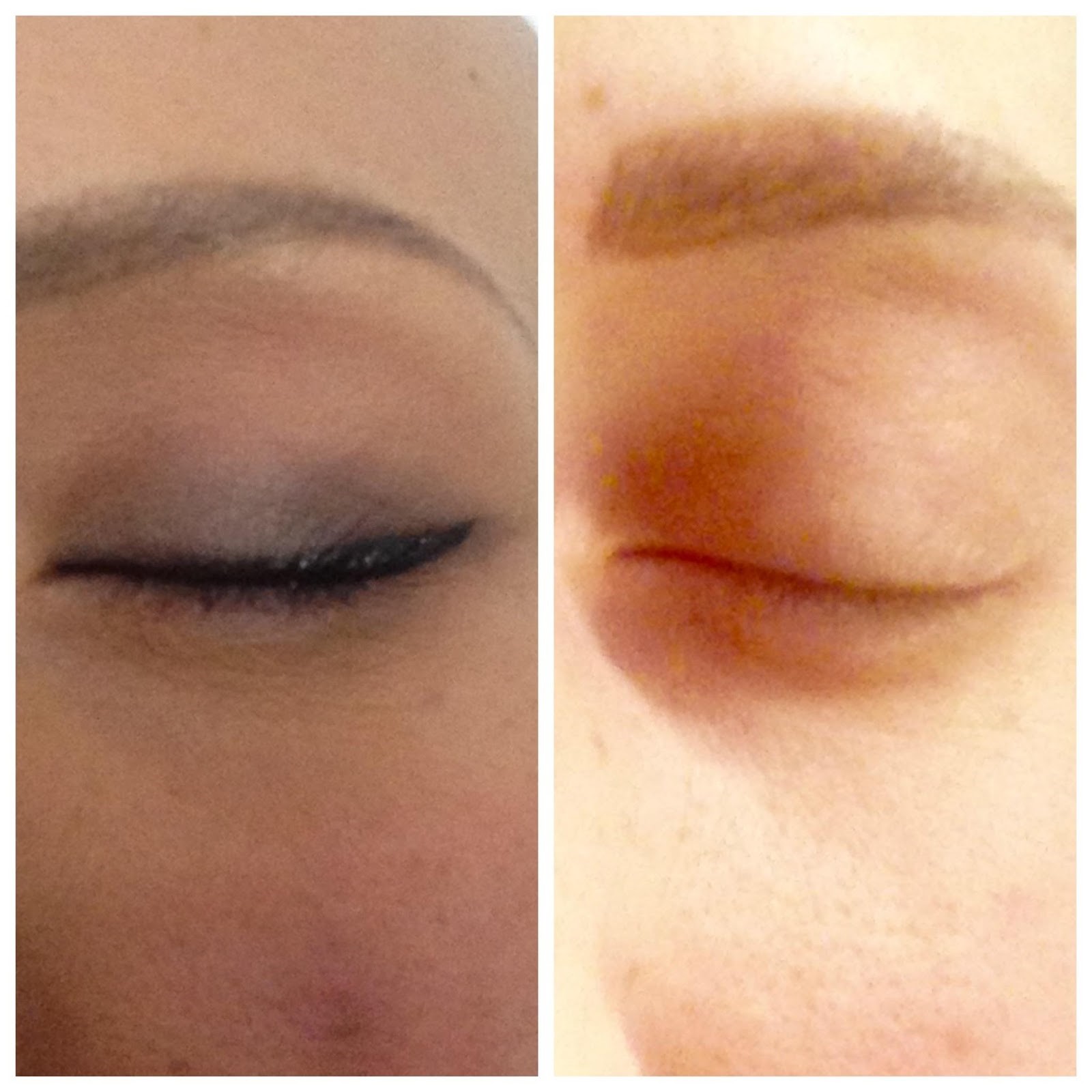 Maquillage et cancer : sublimer son image pour mieux vivre la maladie